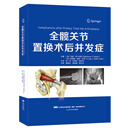 全膝关节置换术：综述与指南