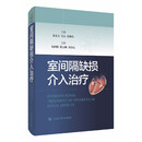 室间隔缺损介入治疗