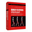 脑瘫步态异常的评估与治疗