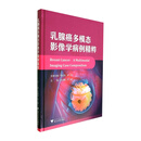 乳腺癌多模态影像学病例精粹