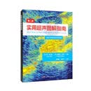 实用超声图解指南（第二版）