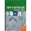 脑卒中磁共振成像Stroke MRI