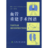血管重建手术图谱