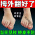 拇外翻神器可拫冶脚趾矫i3正i器大脚拇骨畸形矫i正脚趾重叠疼专用单
