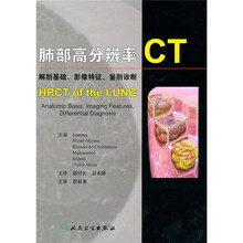 肺部高分辨率CT