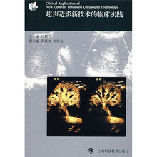 超声造影新技术的临床实践