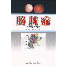 膀胱癌