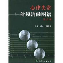 心律失常射频消融图谱