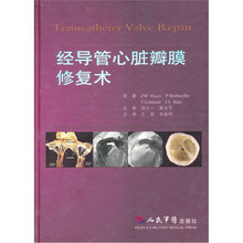 经导管心脏瓣膜修复术