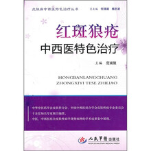 红斑狼疮中西医特色治疗