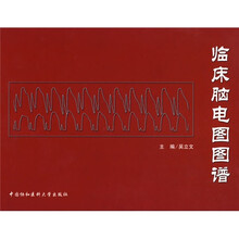 临床脑电图图谱
