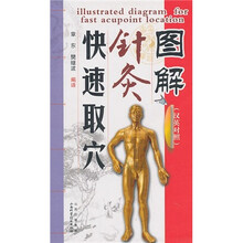 图解针灸快速取穴