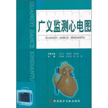 广义监测心电图