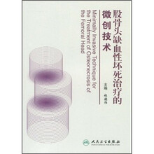 股骨头缺血性坏死治疗的微创技术