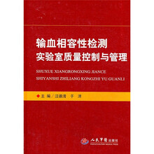 输血相容性检测实验室质量控制与管理