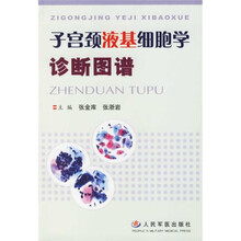 子宫颈液基细胞学诊断图谱