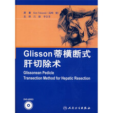 Glisson蒂横断式肝切除术（附光盘2张）