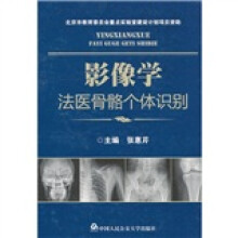 影像学法医骨骼个体识别
