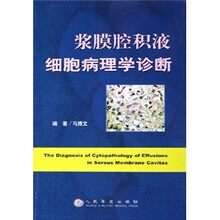 浆膜腔积液细胞病理学诊断