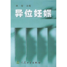异位妊娠