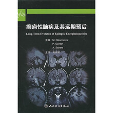 癫痫性脑病及其远期预后