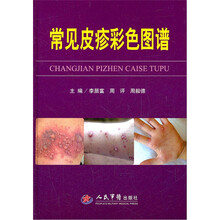 常见皮疹彩色图谱
