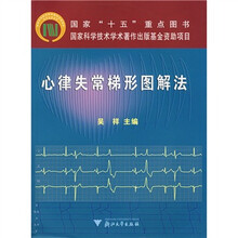 心律失常梯形图解法