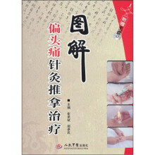 图解偏头痛针灸推拿治疗（附DVD-ROM光盘1张）