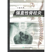 强直性脊柱炎