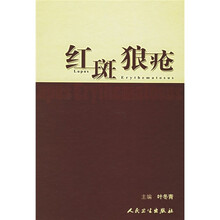 红斑狼疮
