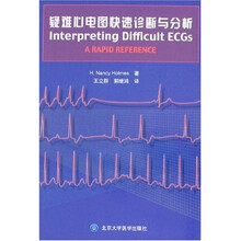 疑难心电图快速诊断与分析