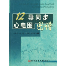 12导同步心电图图谱