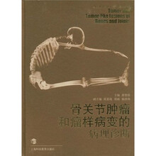 骨关节肿瘤和瘤样病变的病理诊断