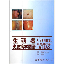 生殖器皮肤病学图谱