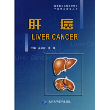 国家重大出版工程项目中国常见癌症丛书:肝癌