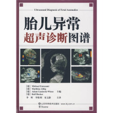 胎儿异常超声诊断图谱