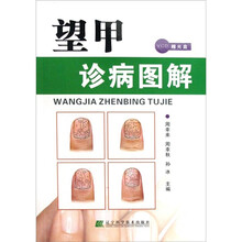 望甲诊病图解（附光盘1张）