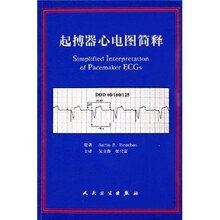 起搏器心电图简释