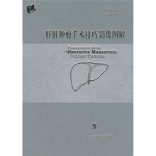 肝脏肿瘤手术技巧影像图解