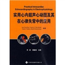 实用心内超声心动图及其在心律失常中的应用