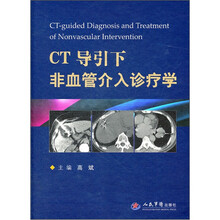 CT导引下非血管介入诊疗学