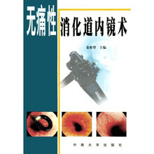 无痛性消化道内镜术
