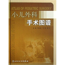 小儿外科手术图谱