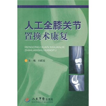 人工全膝关节置换术康复