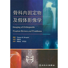 骨科内固定物及假体影像学