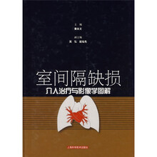 室间隔缺损介入治疗与影像学图解