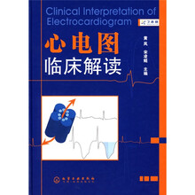 心电图临床解读