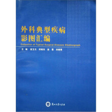 外科典型疾病影图汇编