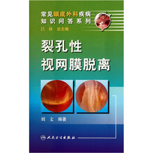 裂孔性视网膜脱离