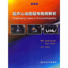 超声心动图疑难病例解析